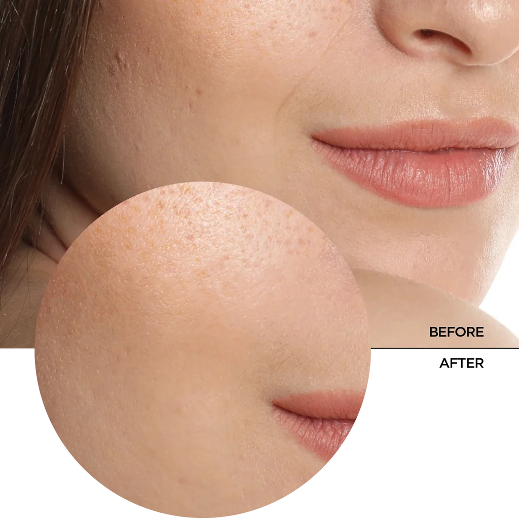 REVOX B77 JUST Hyaluronic Acid 5% Hydrating fluid for face and neck.