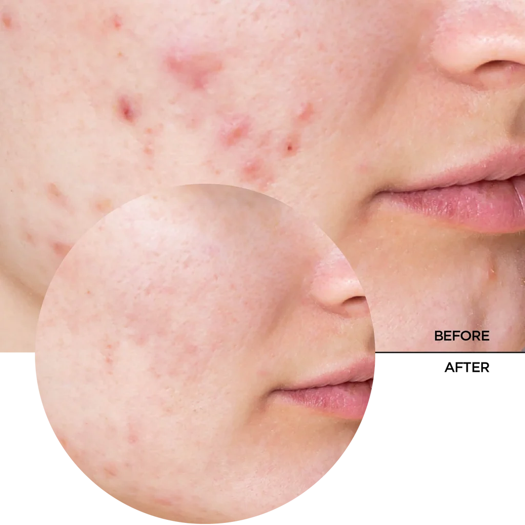 REVOX B77 JUST Niacinamide 10% A daily moisturiser for face and neck.