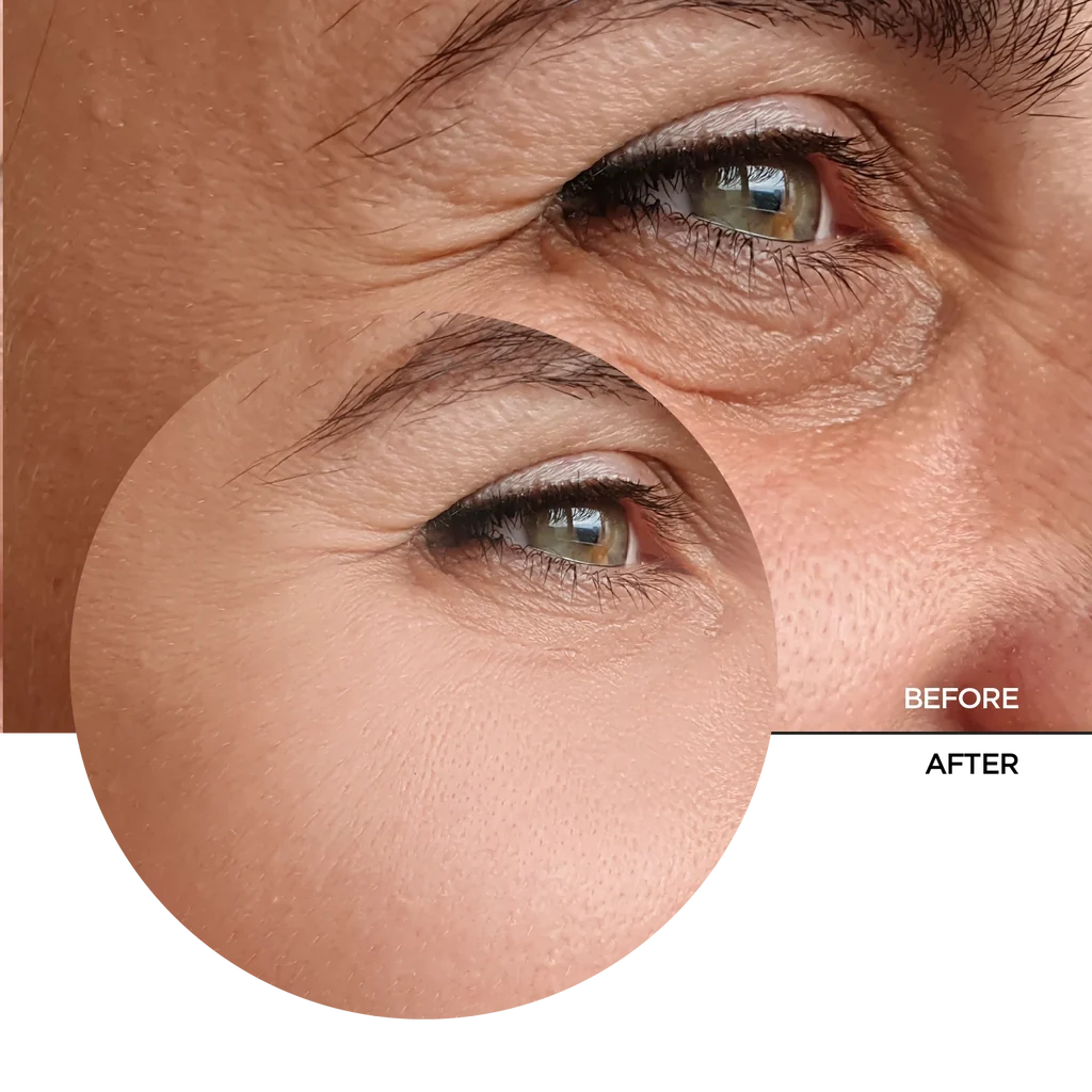 REVOX B77 - Just Retinal, 30 ml Serum.