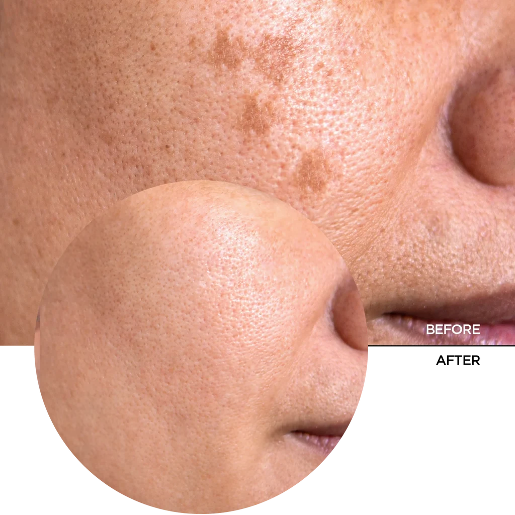 REVOX B77 JUST Vitamin C 20% An antioxidant serum for face and neck.